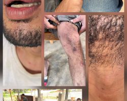 Manajer PT Hindoli Cargill dan 10 Orang Brimob Diduga Aniaya Seorang Warga Kecamatan Keluang